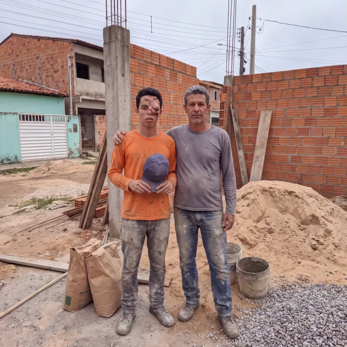 Murilo, com uma lesão no rosto, ao lado do pai na obra de alvenaria onde os dois trabalham